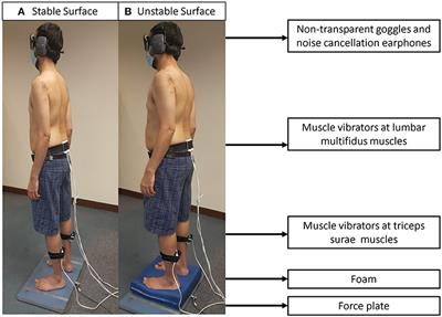 Differences in Proprioception Between Young and Middle-Aged Adults With and Without Chronic Low Back Pain